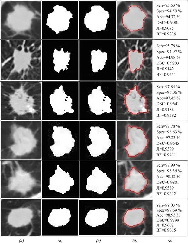 News update: Lung Segmentation in CT scans with Residual Convolutional and Attention Learning-based U-Net