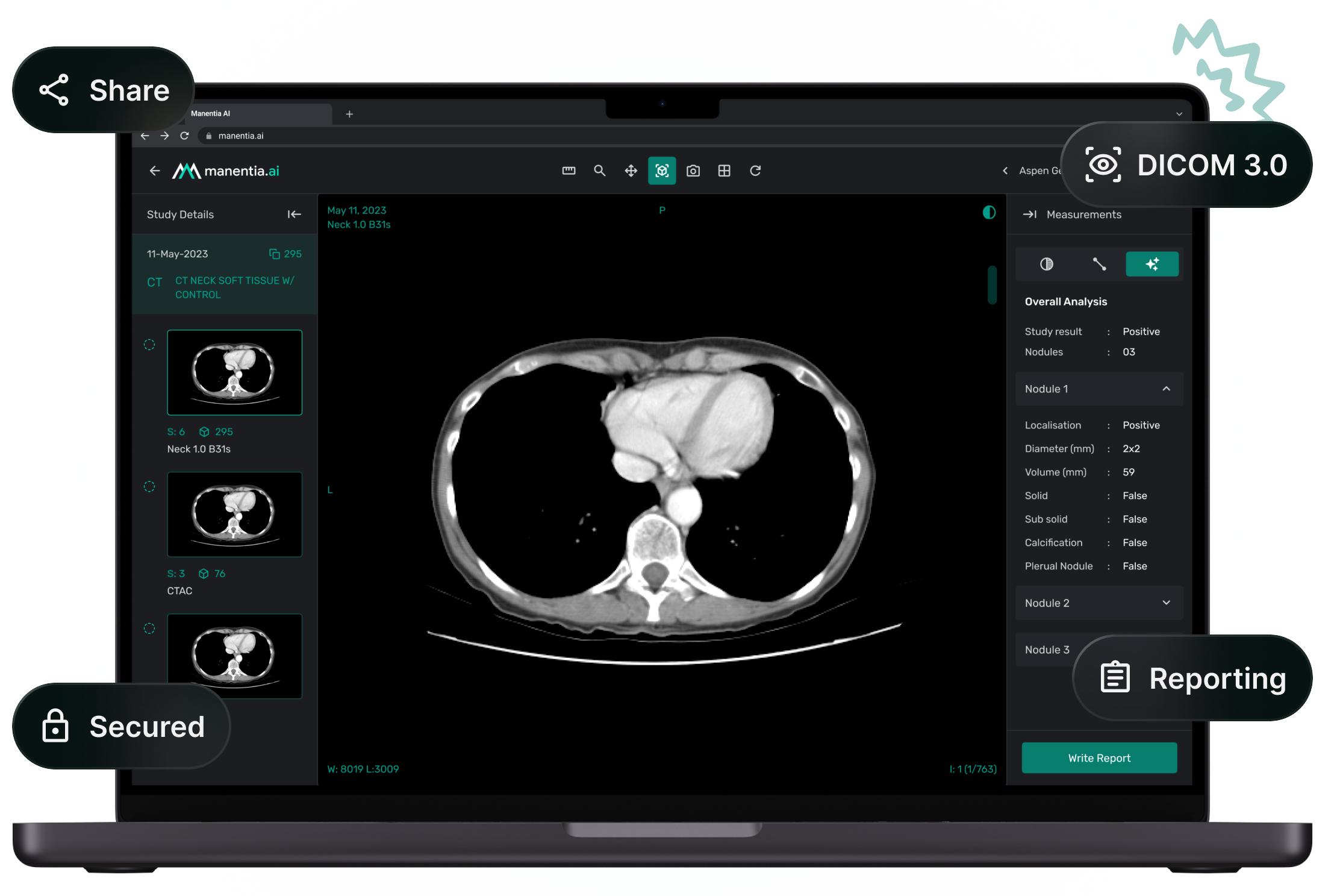 tele-radiology illustration image