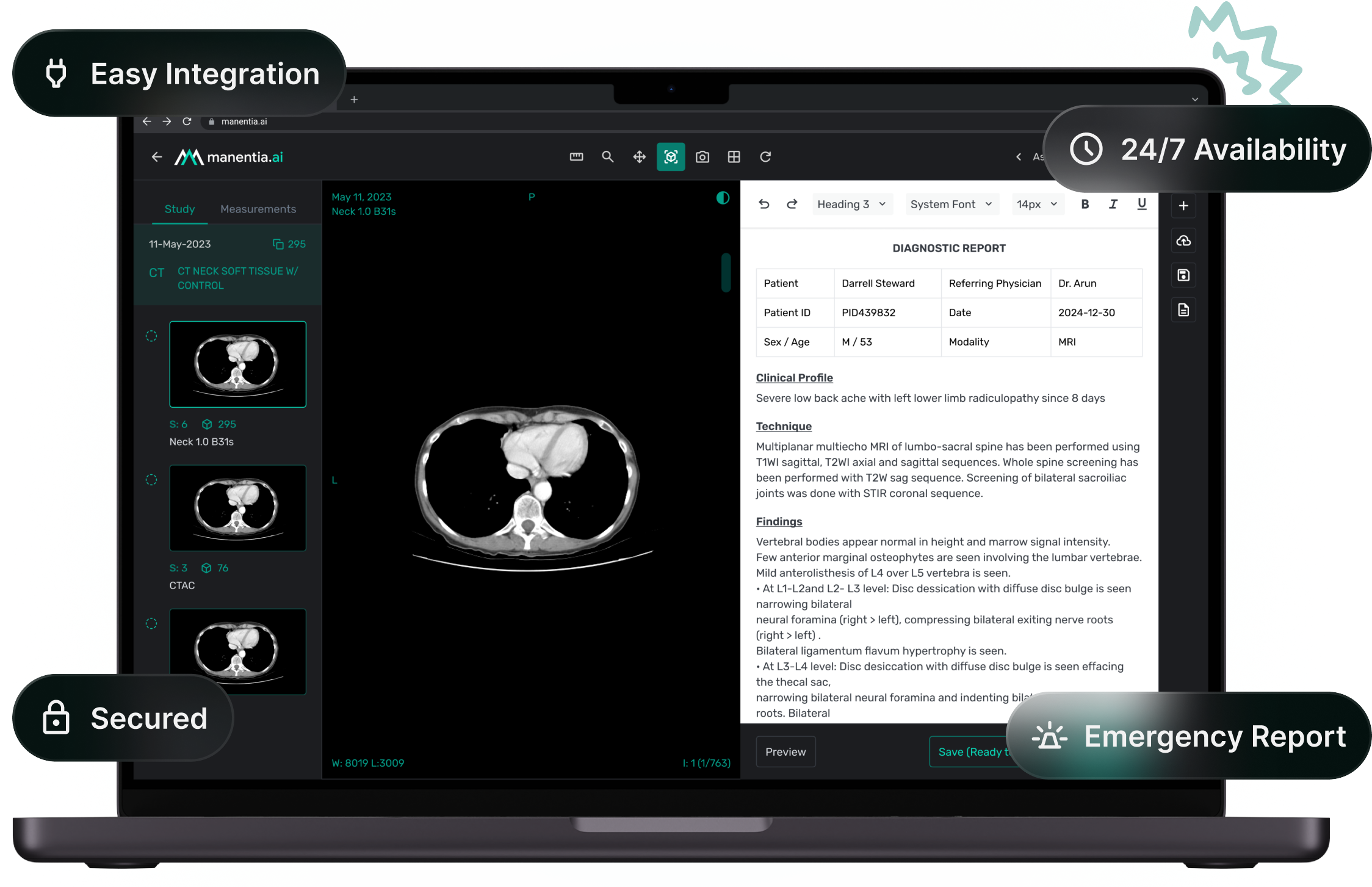 teleradiology illustration image